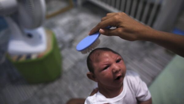 Ребенок, больной микроцефалией в городе Ресифе, Бразилия. 9 февраля 2016