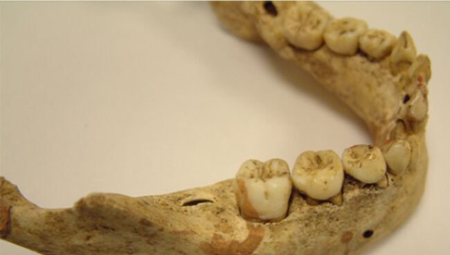 Челюсть ребенка, найденная на Кентерберийском кладбище