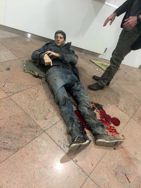 Пострадавшие во время взрыва в аэропорту Брюсселя. 22 марта 2016