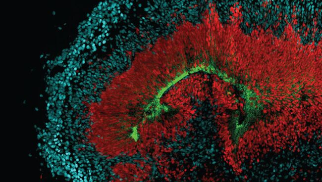 Мини-мозг, выращенный в пробирке. Зеленым отмечены рецепторы AXL Мини-мозг, выращенный в пробирке. Зеленым отмечены рецепторы AXL