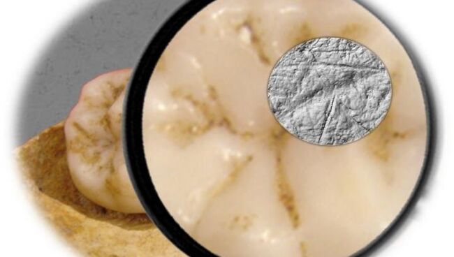 Зуб кроманьонца и царапины на его эмали Зуб кроманьонца и царапины на его эмали