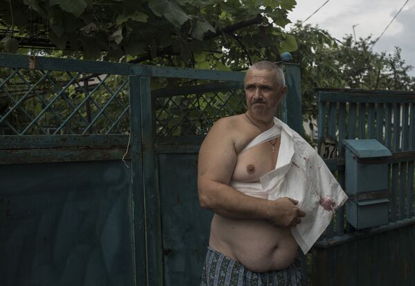 Житель Горловки Константин Беляев, раненный осколком во время обстрела