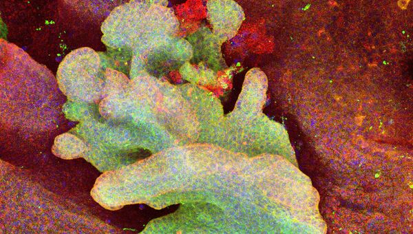 Карцинома кожи, рождающаяся из одной стволовой клетке в хвосте мыши
