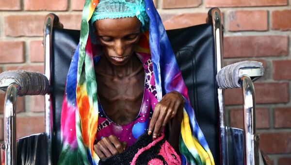 18-летняя пациентка больницы в Йемене, страдающая от истощения. Архивное фото