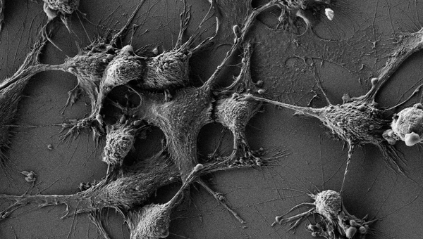 Клетки мышей, которых ученые защитили от радиации при помощи наночастиц