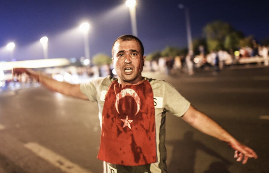 Мужчина, раненый во время июльских протестов в Турции. 16 июля 2016 года 