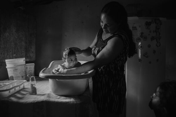 Victims of the Zika Virus фотографа Lalo de Almeida занявшего второе место в категории Проблемы современности в фотоконкурсе World Press Photo