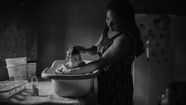 Victims of the Zika Virus фотографа Lalo de Almeida занявшего второе место в категории Проблемы современности в фотоконкурсе World Press Photo