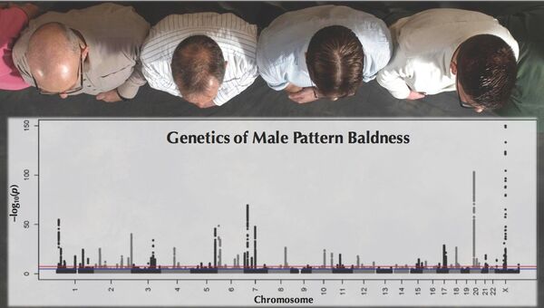 Лысеющие мужчины и гены облысения в ДНК человека