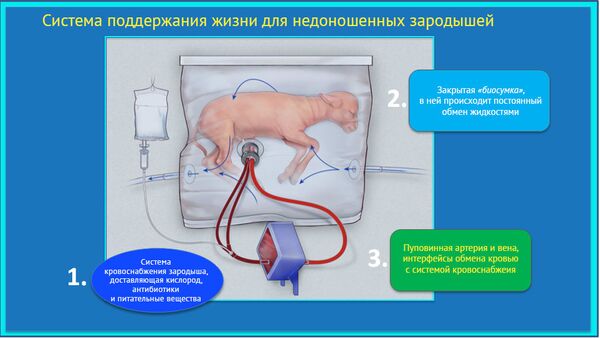Искусственная матка, созданная учеными из США Искусственная матка, созданная учеными из США