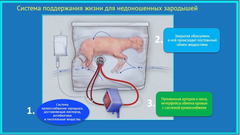 Искусственная матка, созданная учеными из США Искусственная матка, созданная учеными из США