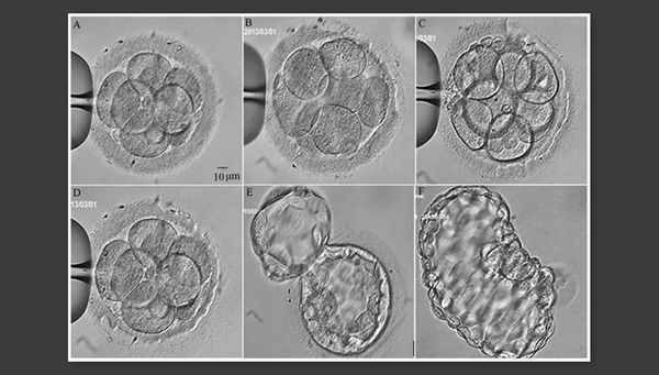 Процесс заморозки эмбрионов