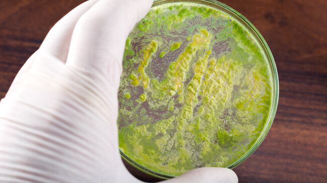 Чашка Петри с бактериями. Архивное фото