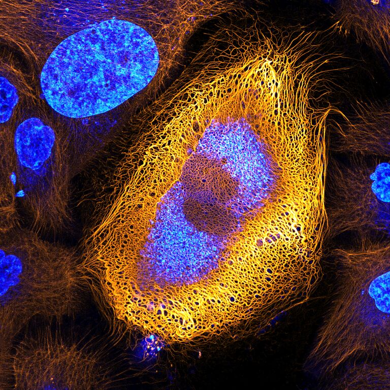 Клетки кожи человека. Флуоресцентные пятна - кератин
