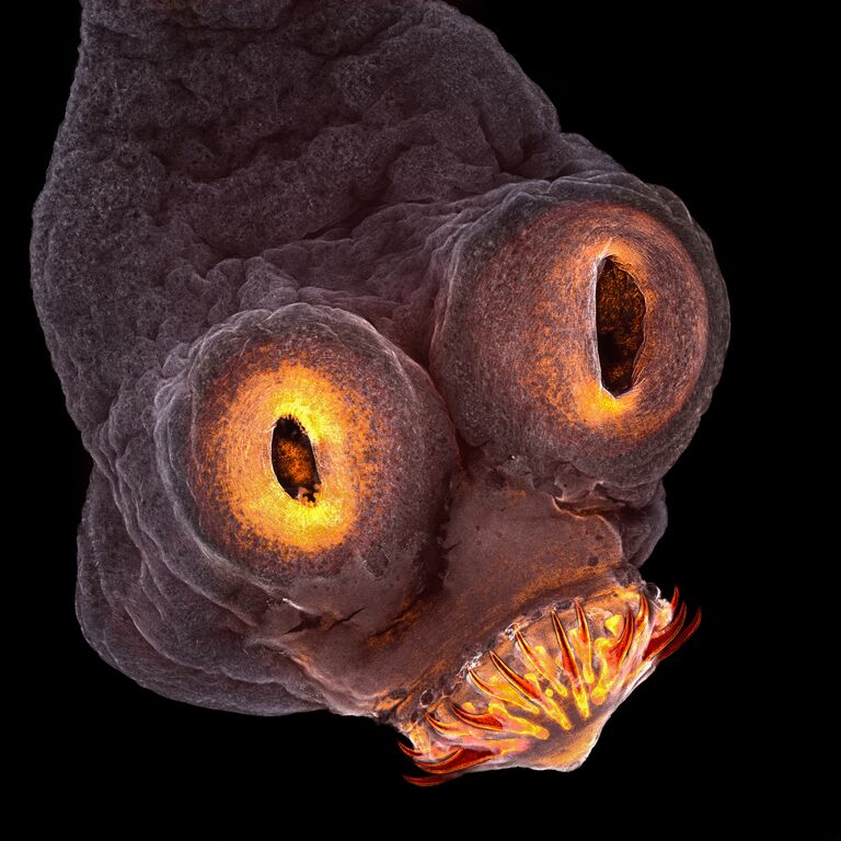 Голова ленточного червя. 200-кратное увеличение