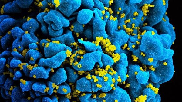 Т-клетка, зараженная ВИЧ