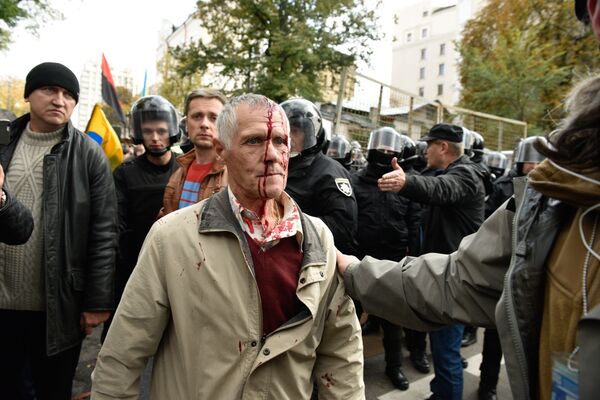Пострадавший участник акции протеста у здания Верховной рады Украины в Киеве
