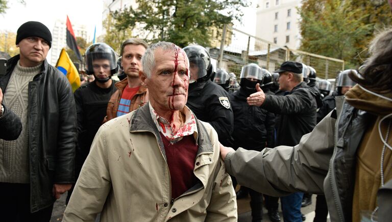 Пострадавший участник акции протеста у здания Верховной рады Украины в Киеве
