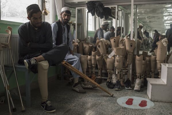 Пациенты ортопедической клиники в Кабуле