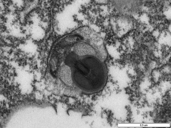 Охотничьий гарпун Ancoracysta twista, самого необычного и чужого существа на земле Охотничьий гарпун Ancoracysta twista, самого необычного и чужого существа на земле