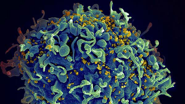 ВИЧ атакует клетку человека
