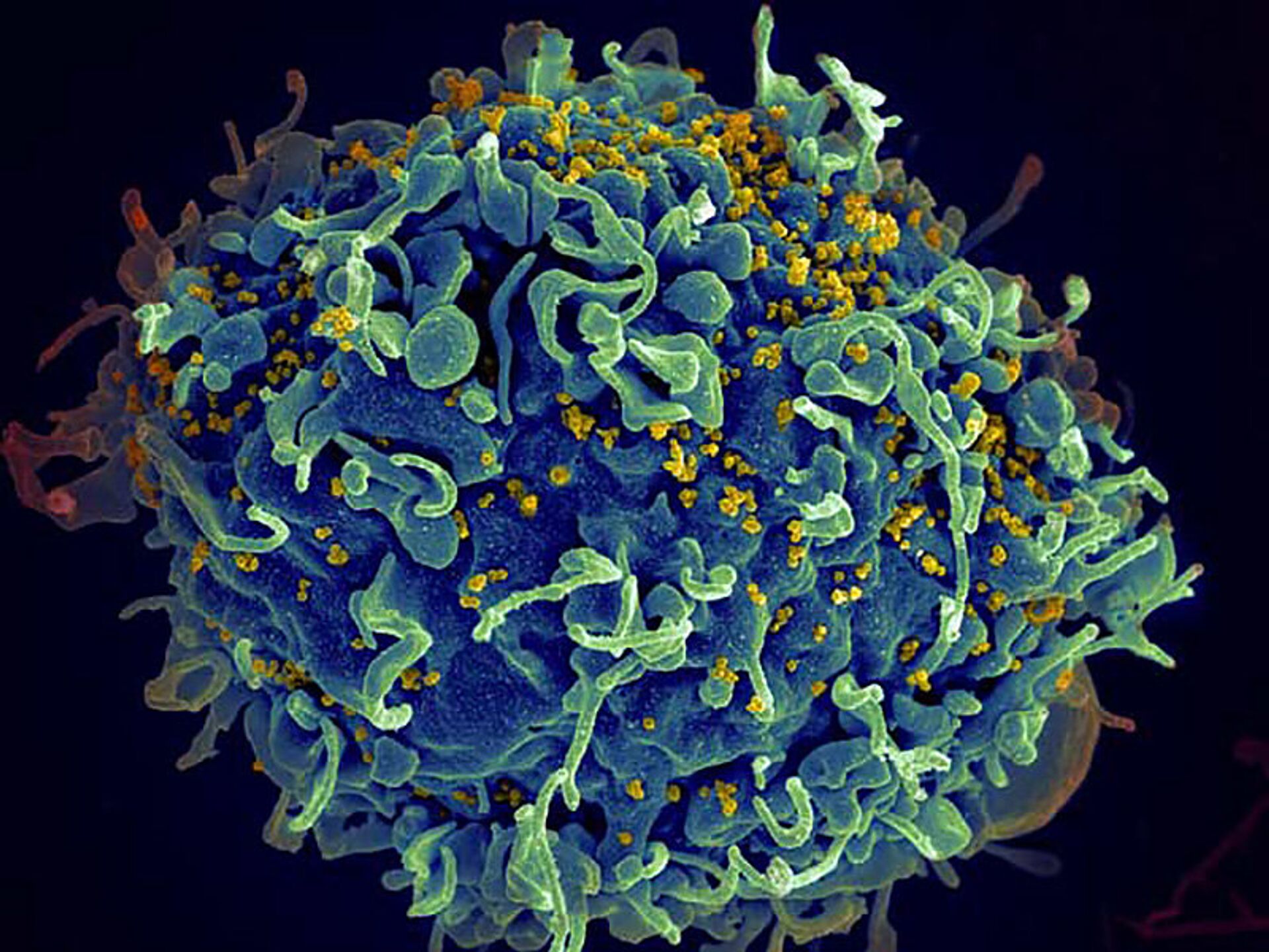 Контрольная работа по теме ВИЧ — вирус иммунодефицита человека