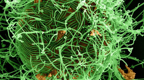 Вирус Эбола на человеческой клетке. Архивное фото