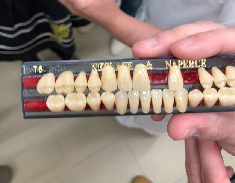 Зубные протезы, напечатанные на 3D-принтере, студентами СПбГУ из команды CeramicPrints Зубные протезы, напечатанные на 3D-принтере, студентами СПбГУ из команды CeramicPrints