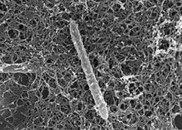 Бактерия Candidatus Desulforudis audaxviator, имеющая форму палочки, живет в полном одиночестве глубоко под землей 