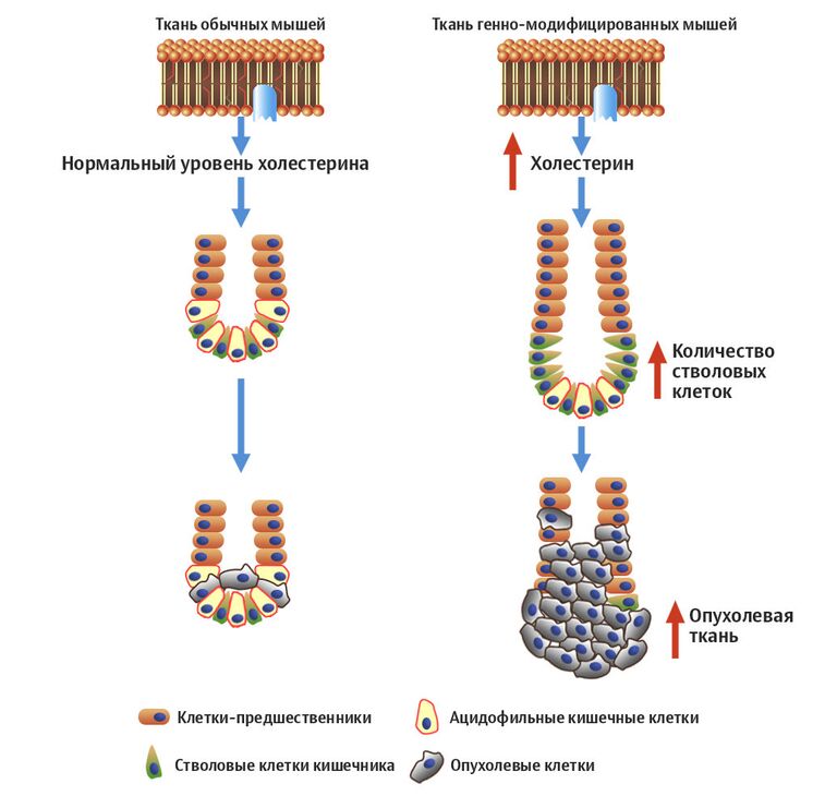 Как холестерин вызывает рак Как холестерин вызывает рак