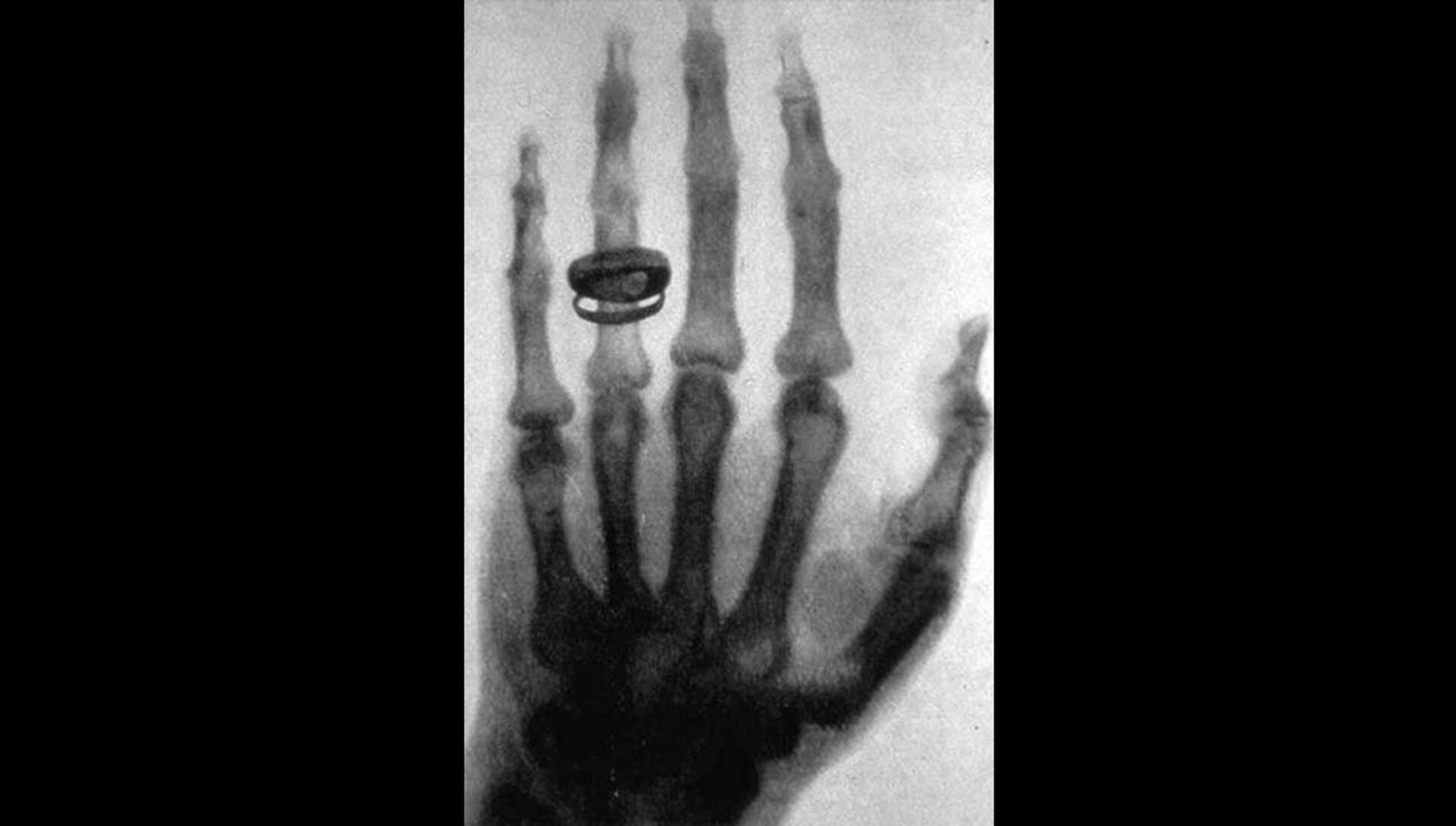 Снимок руки, сделанный Рентгеном 23 января 1896 года - РИА Новости, 1920, 22.10.2020