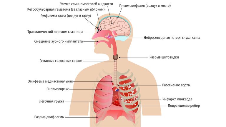 Оргазм от чихания