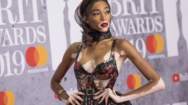 Канадская модель Винни Харлоу, страдающая витилиго, перед ежегодной церемонией вручения музыкальных наград Великобритании в области поп-музыки Brit Awards в Лондоне