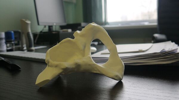 Примерочная модель искусственного сустава из биосовместимого пластика, распечатанная на 3D-принтере