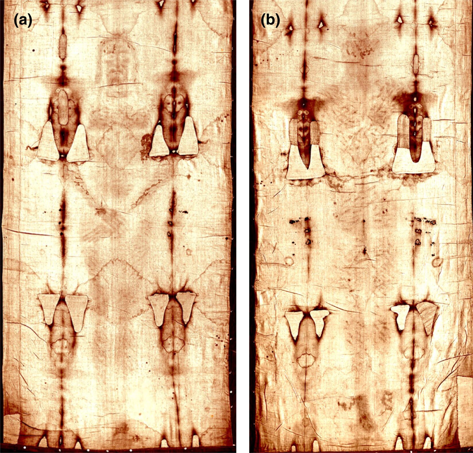 Туринская плащаница до реставрации 2002 года. Лобное (а) и дорсальное (б)  - РИА Новости, 1920, 07.06.2022