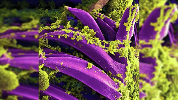 Микроб чумы опутал слизистую преджелудка блохи Xenopsylla cheopis