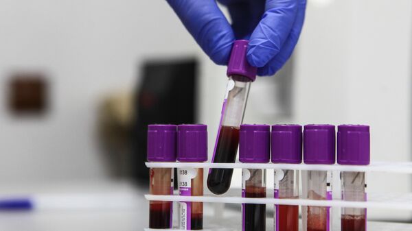Пробирки с образцами крови для исследований