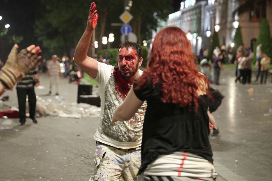 Мужчина, пострадавший во время акции протеста у здания парламента Грузии в Тбилиси