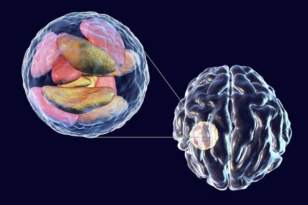 Токсоплазма Toxoplasma gondii Токсоплазма Toxoplasma gondii
