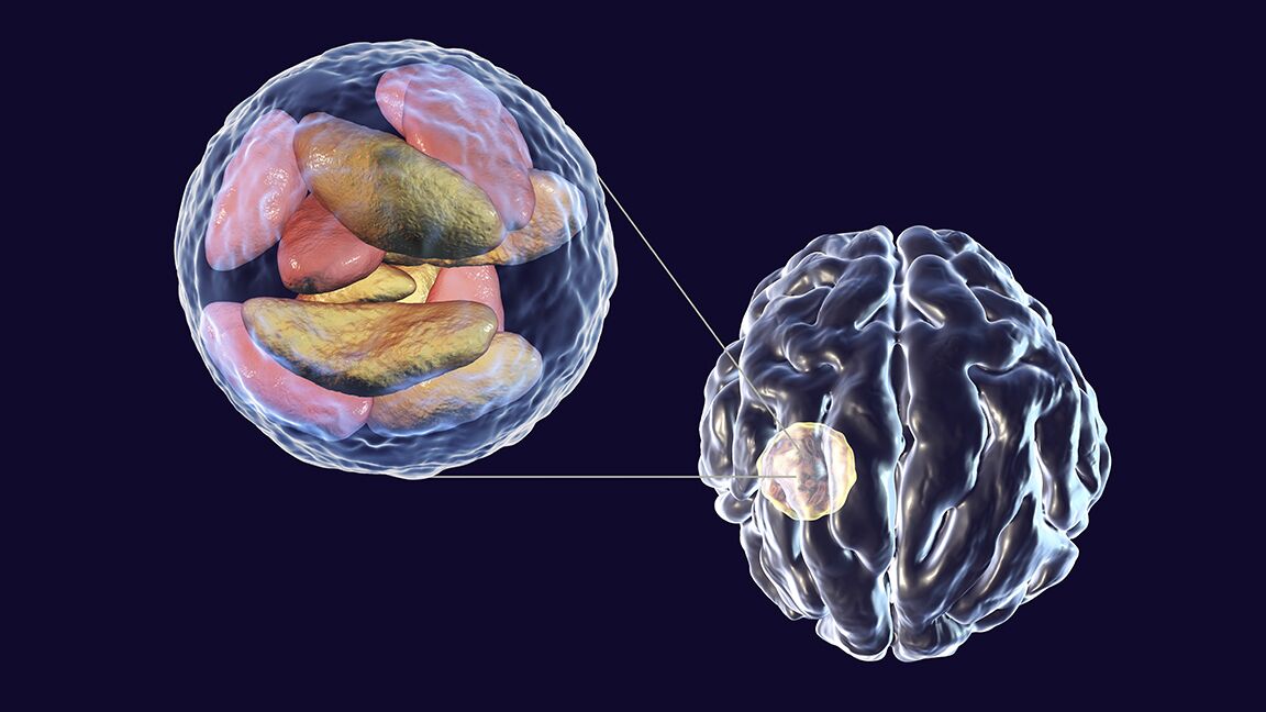 Токсоплазма Toxoplasma gondii - РИА Новости, 1920, 12.05.2021