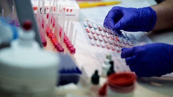 В рамках Всемирного дня тромбоза можно будет проверить свертываемость крови