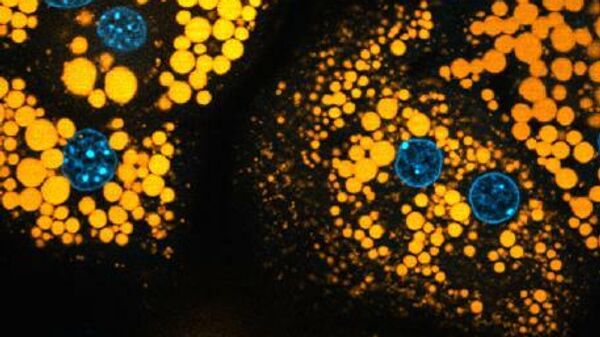 Фотография отдельных жировых капель (оранжевые) в клетках печени. Синие — ядра клеток