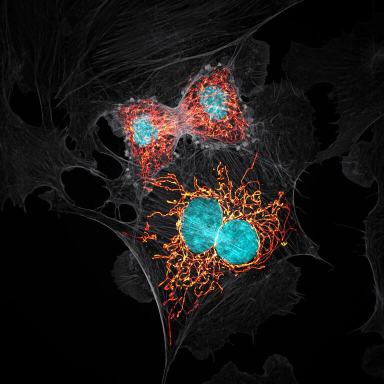 Jason M. Kirk. Работа победителя конкурса фотомикрографии 2019 Nikon’s Small World