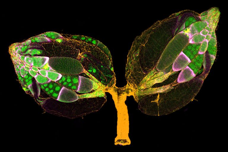 Dr. Yujun Chen & Dr. Jocelyn McDonald. Работа победителя конкурса фотомикрографии 2019 Nikon’s Small World