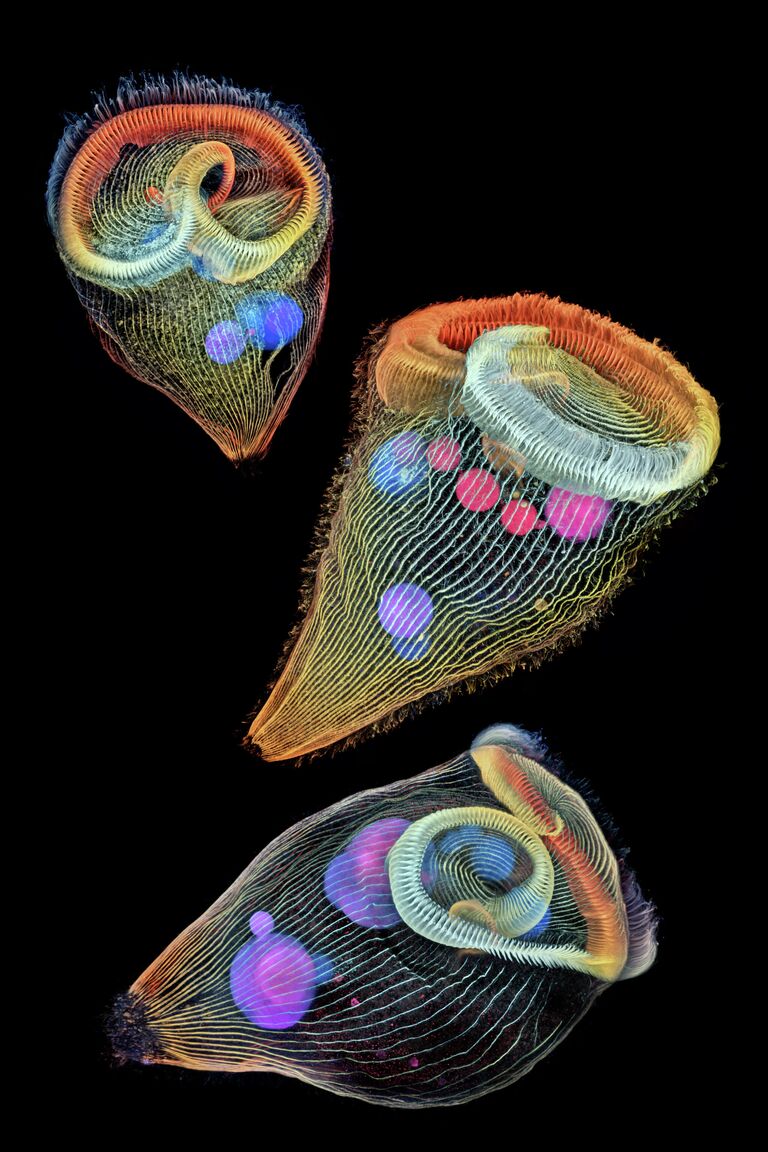 Dr. Igor Siwanowicz. Работа победителя конкурса фотомикрографии 2019 Nikon’s Small World