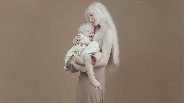 Словно из сказки: завораживающая внешность сестер-альбиносов из Казахстана