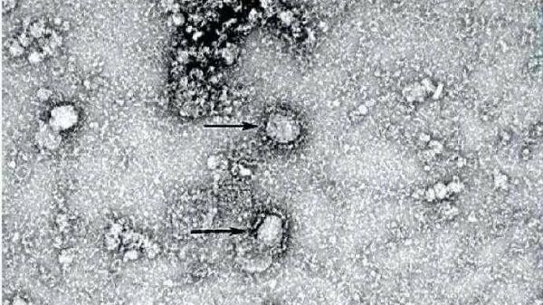 Изображение вуханьского коронавируса , полученное с помощью электронного микроскопа