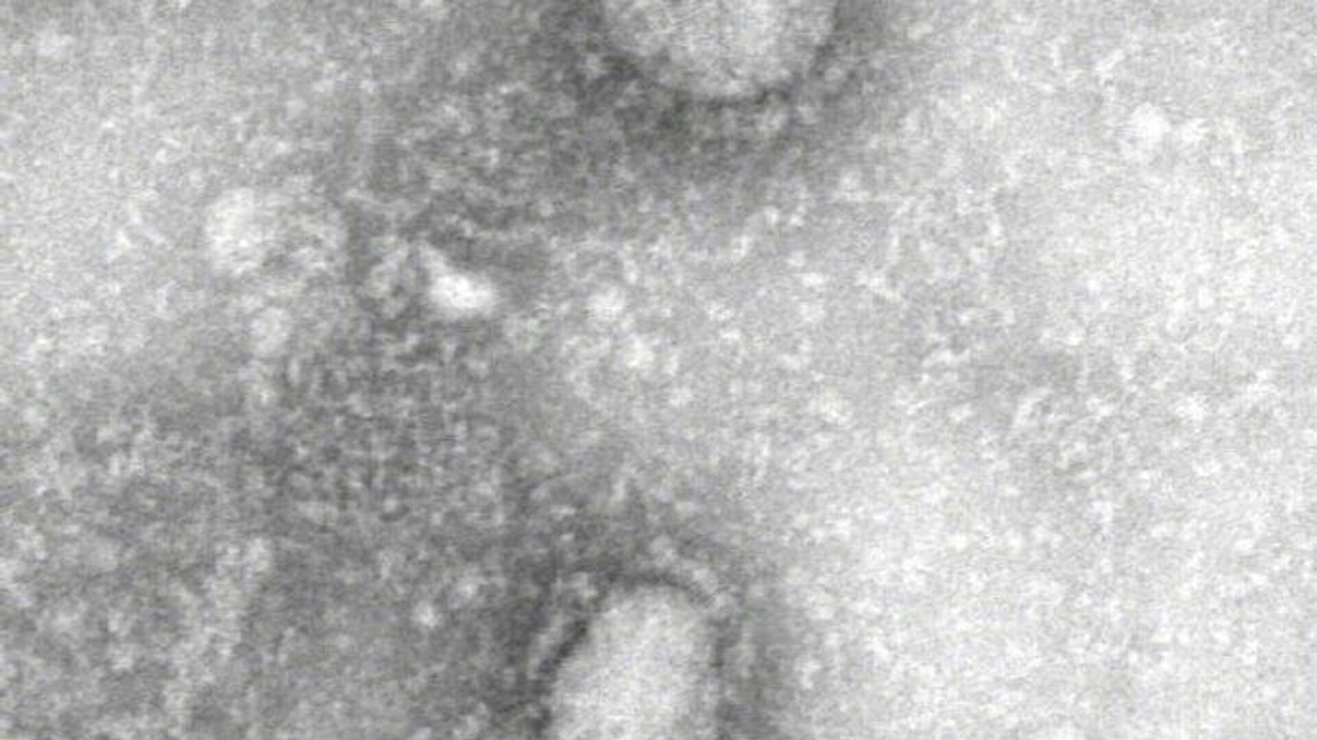 Изображение коронавируса, полученное с помощью электронного микроскопа - РИА Новости, 1920, 10.06.2022