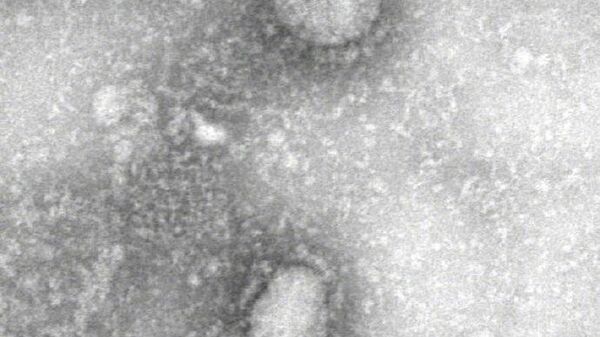 Изображение коронавируса, полученное с помощью электронного микроскопа