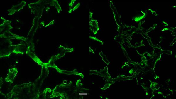 Конфокальный флуоресцентный микроснимок окаменелого мицелия грибов. Хитин, подкрашенный флуоресцентным красителем, светится зеленым светом на стенках нитей мицелия
